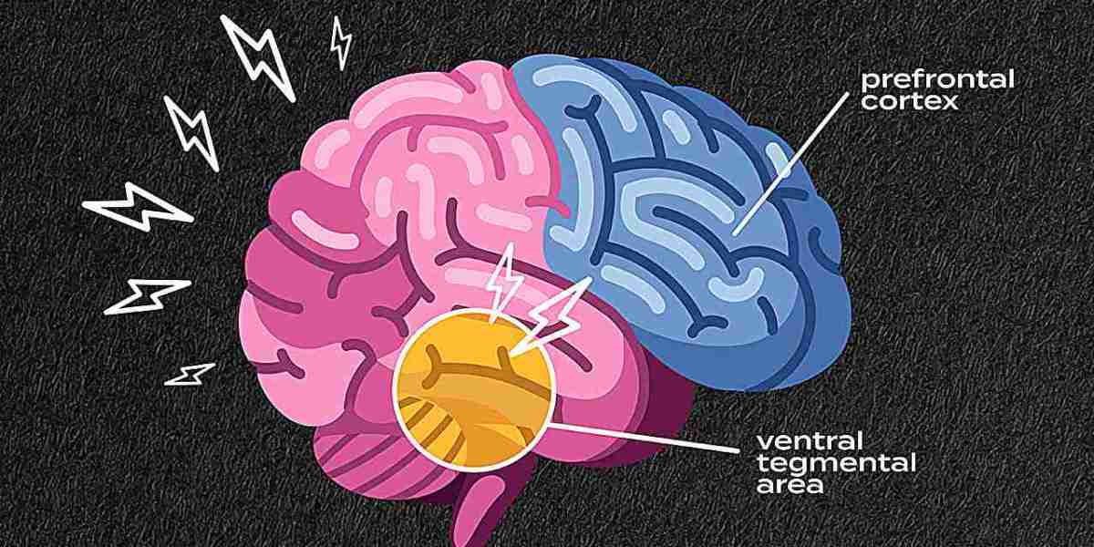 What Causes a Brain Stroke? Key Risk Factors Explained