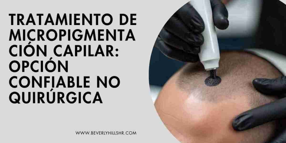 Tratamiento de Micropigmentación Capilar: Opción Confiable No Quirúrgica
