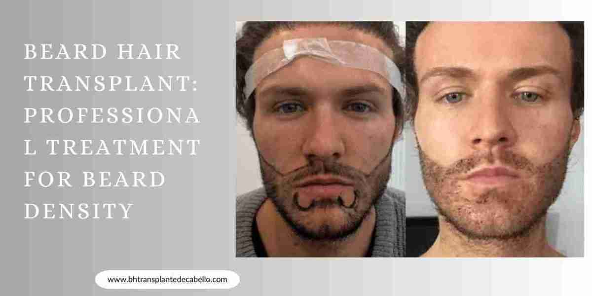 Beard Hair Transplant: Professional Treatment for Beard Density