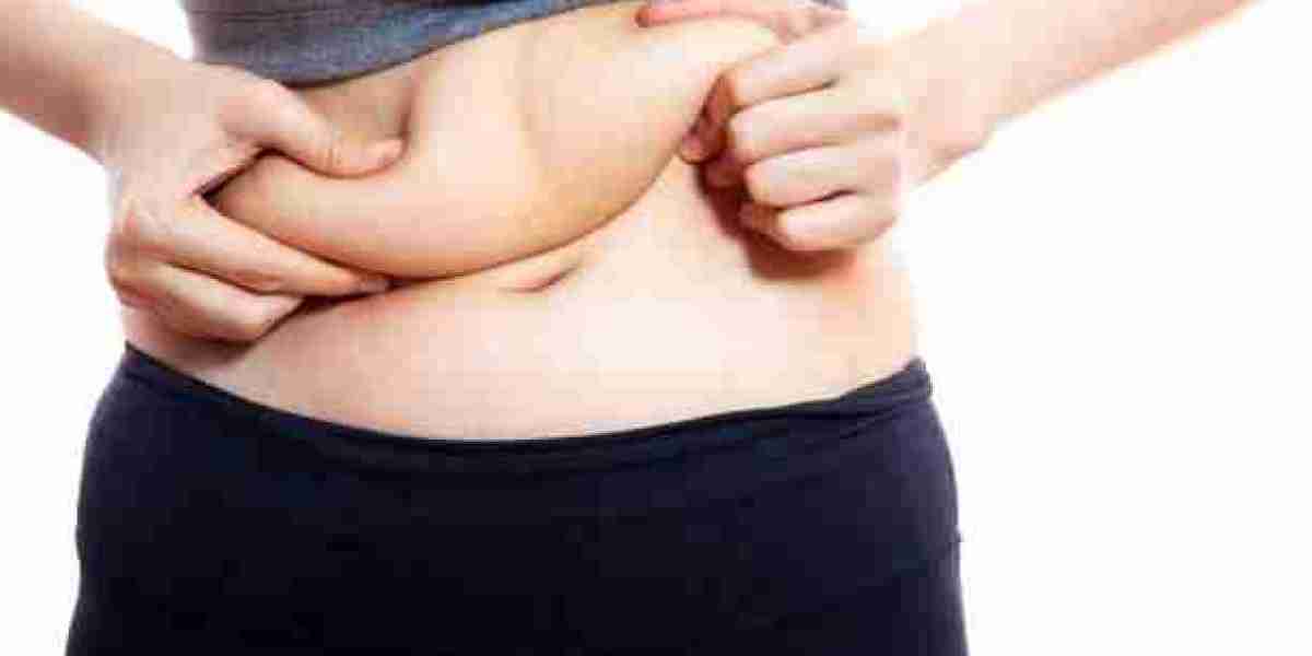 Liposuction for Targeted Fat Reduction in Riyadh