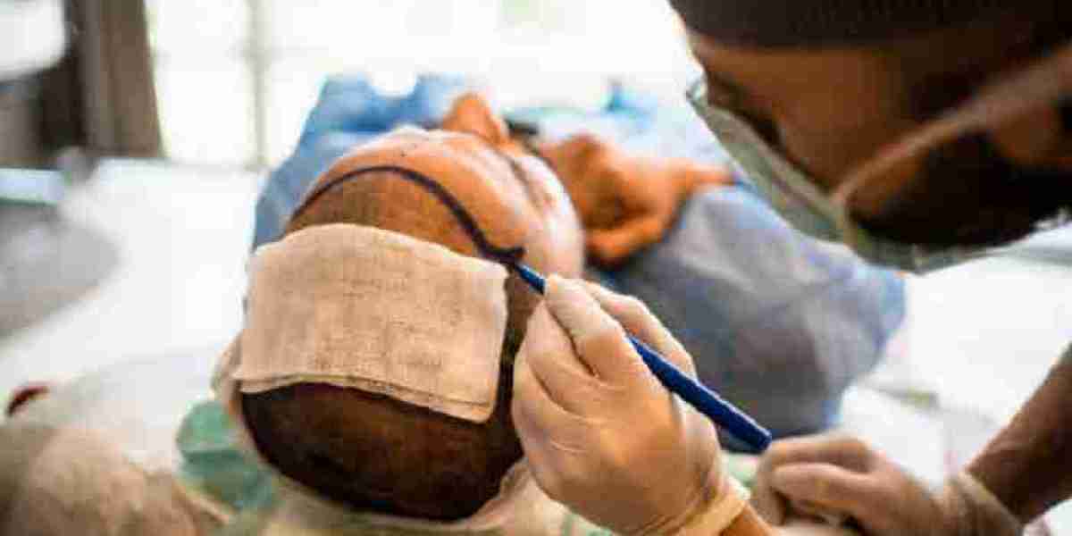 Post-Transplant Care and Recovery Tips for Hair Restoration Patients in Saudi Arabia