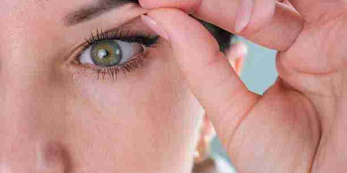 Eyelid Surgery in Riyadh: An Educational Look at the Process and Outcomes