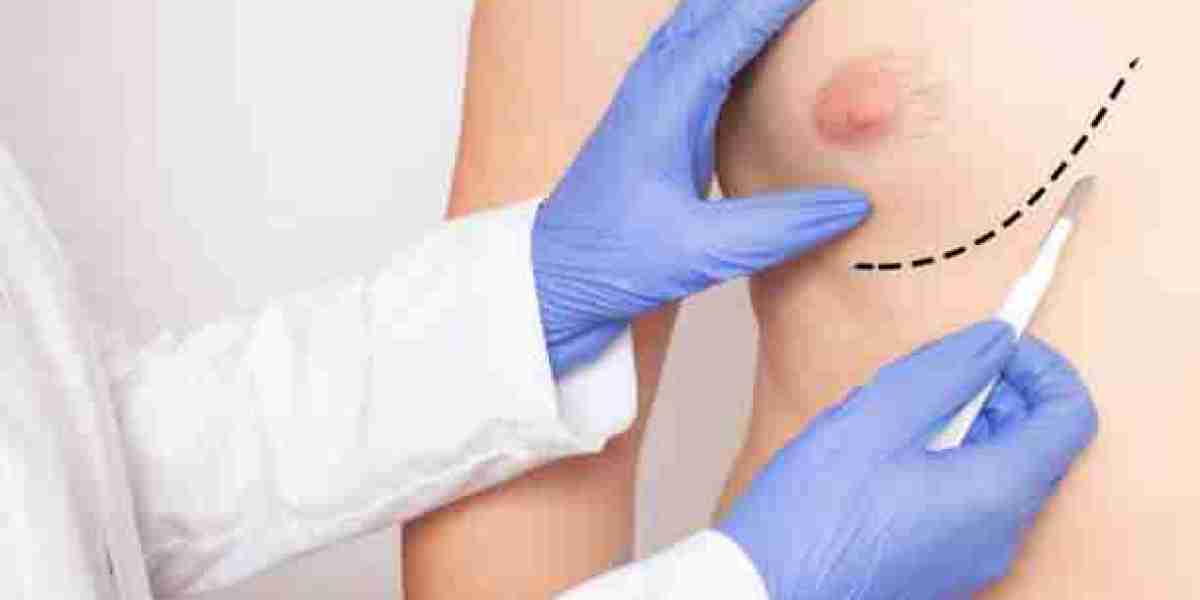 The Surgical Process for Gynecomastia in Riyadh: An Overview