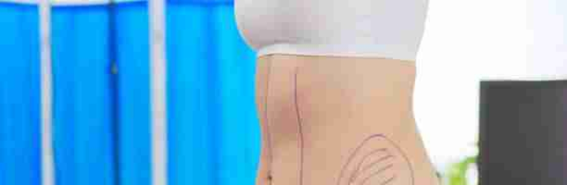 liposuction in riyadh Cover Image