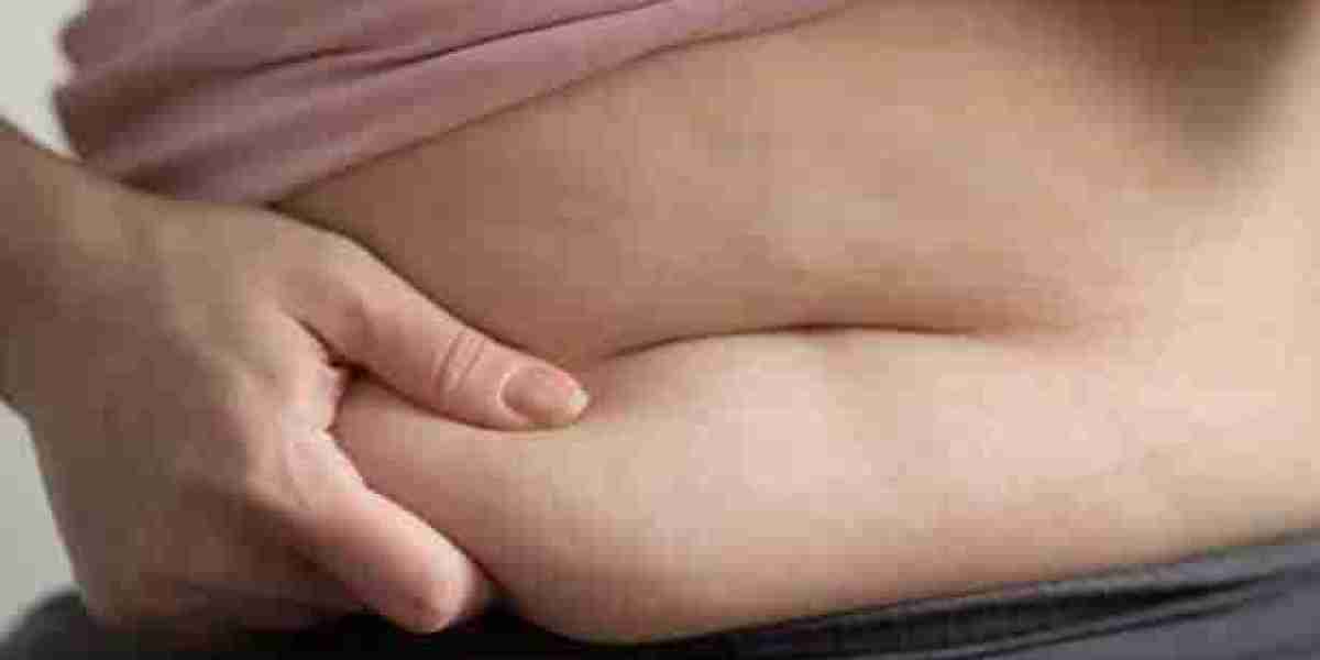 Top Questions About Tummy Tuck Cost in Riyadh 2026 Procedures Answered for Riyadh Patients