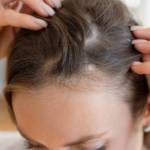 Hair Loss Treatment in Riyadh Profile Picture