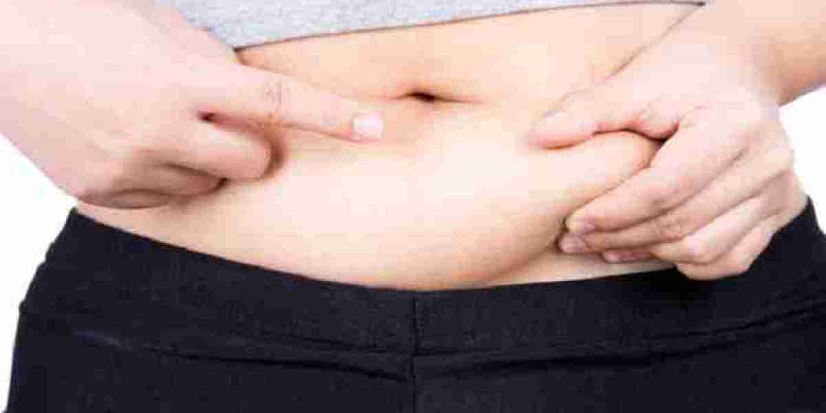 Liposuction in Riyadh: Myths and Facts You Should Know