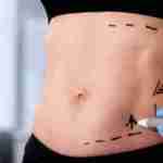 liposuction in riyadh profile picture