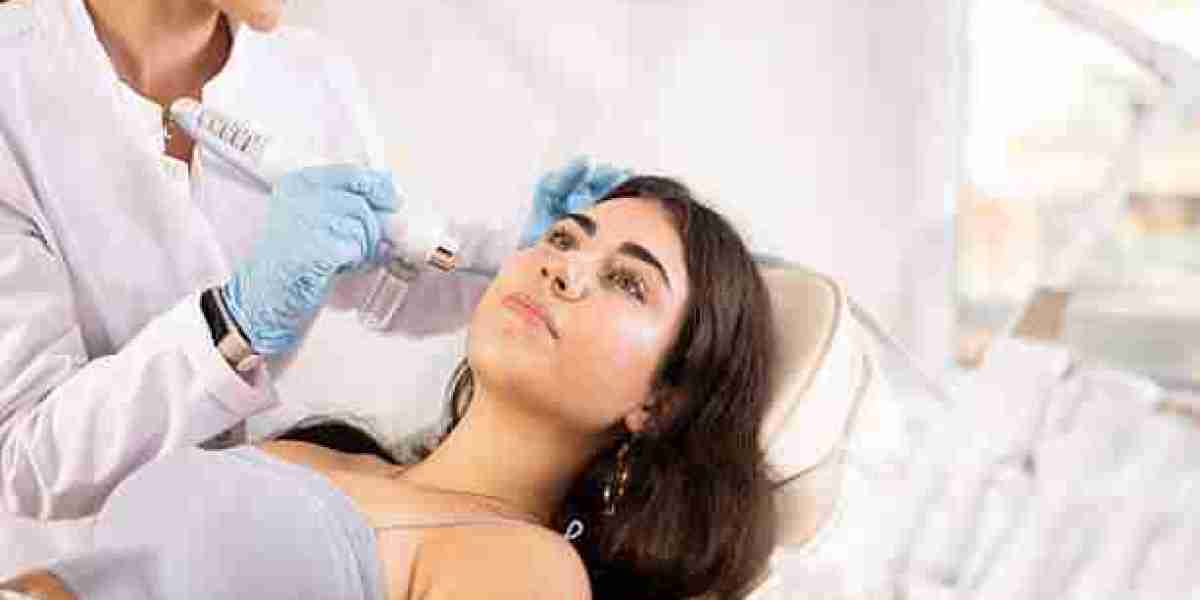 Unlocking Clearer Skin with Q-Switch Laser in Riyadh