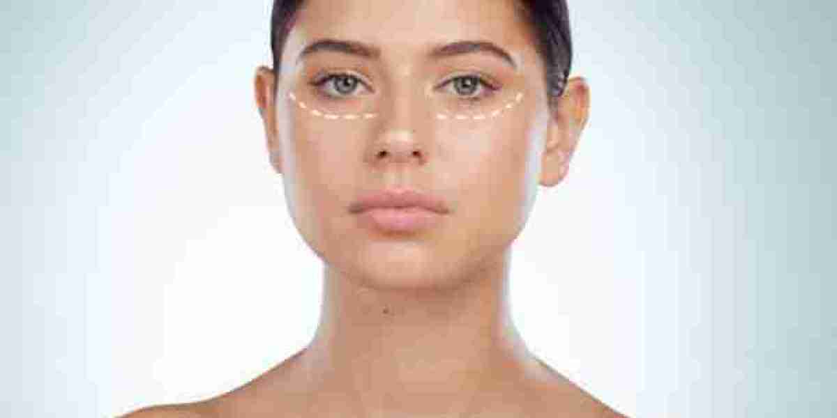 Under Eye Fillers for Treating Hollow and Sunken Eyes