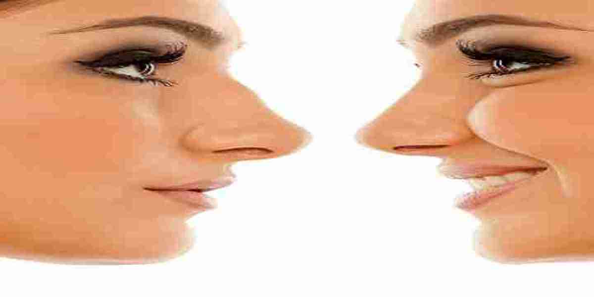 The Science Behind Rhinoplasty and Facial Aesthetics in Riyadh
