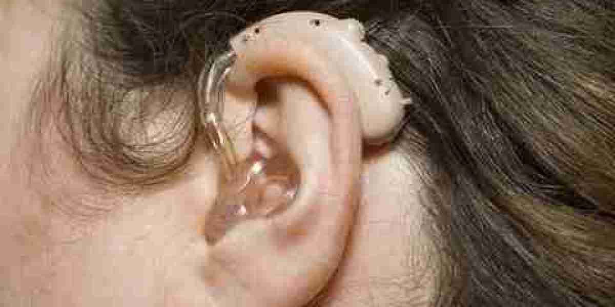 I Finally Bought a Hearing Machine. Let Me Tell You About the Price