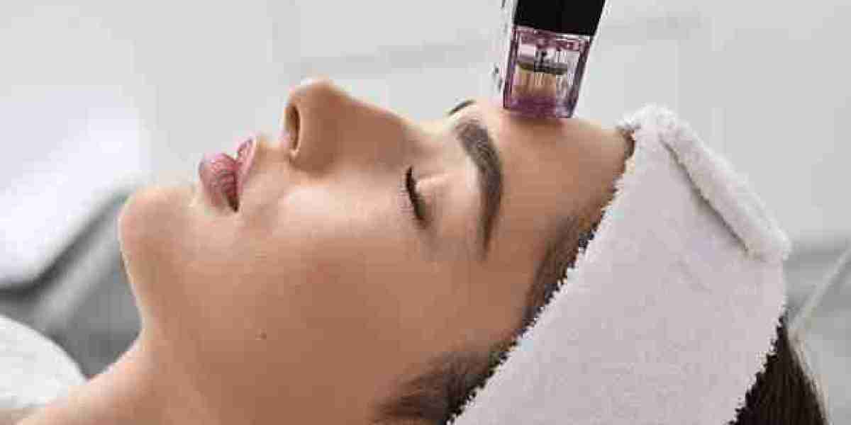 Radio Frequency Treatment for Comprehensive Skin Renewal
