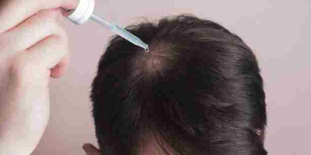 The Role of Technology in Modern Hair Transplant in Riyadh