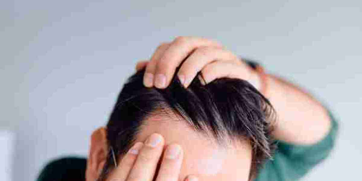 How Exosome Therapy For Hair Loss In Riyadh Addresses Hair Loss Causes in Riyadh