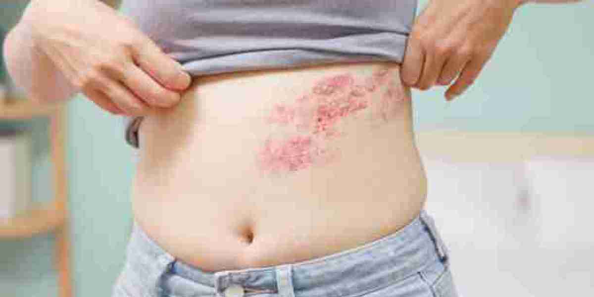 Skin Diseases and the Importance of Proper Diagnosis