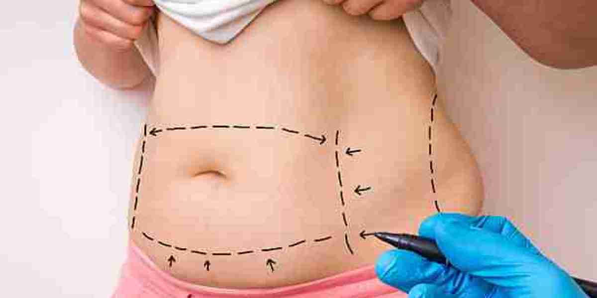 Fat Melting Injections to Shape Your Ideal Figure