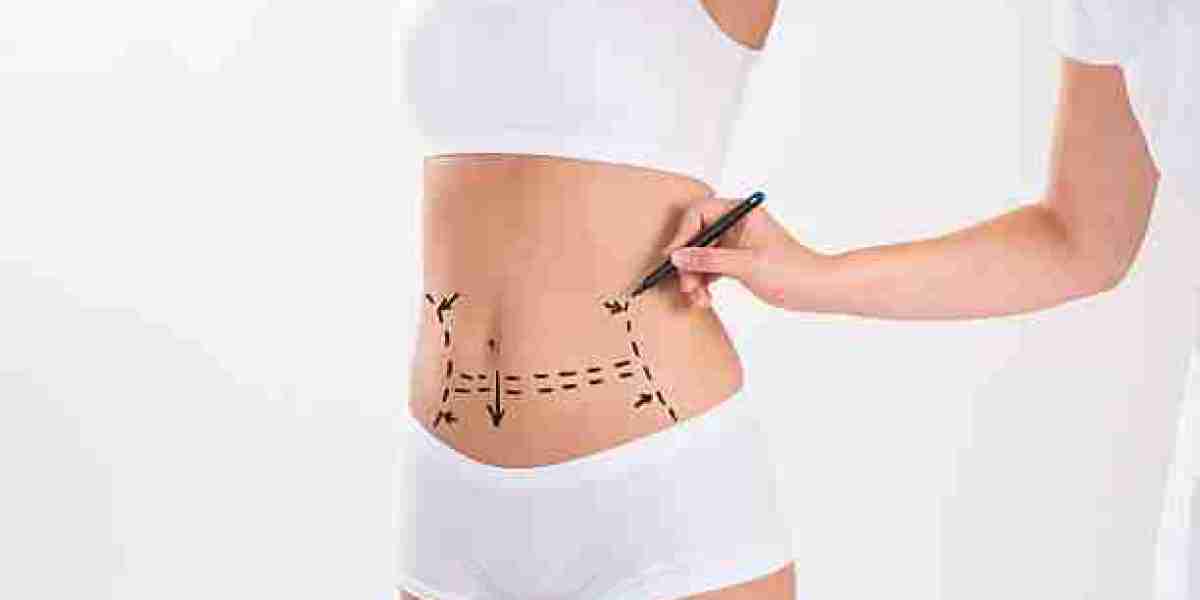 Liposuction for Personalized Body Reshaping Goals
