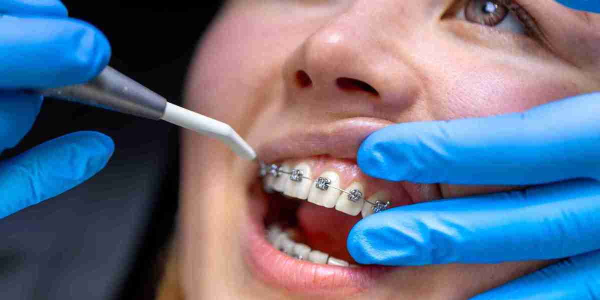 Best Orthodontist in Rockville: Why Experience Matters More Than Cost