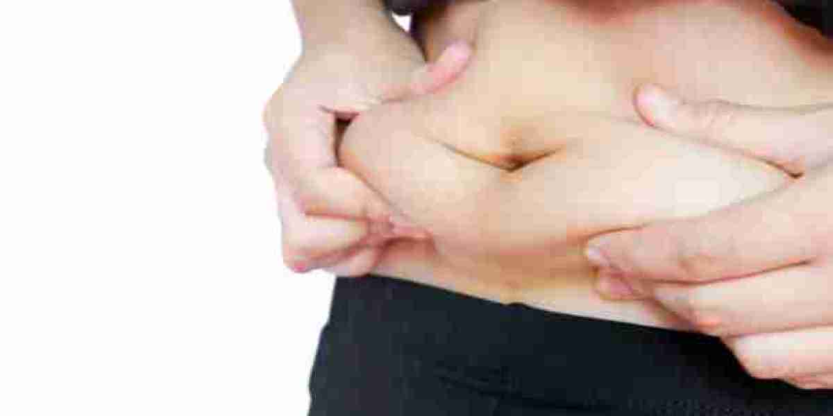 Affordable Tummy Tuck offer in Riyadh: Special Rates for a Limited Time