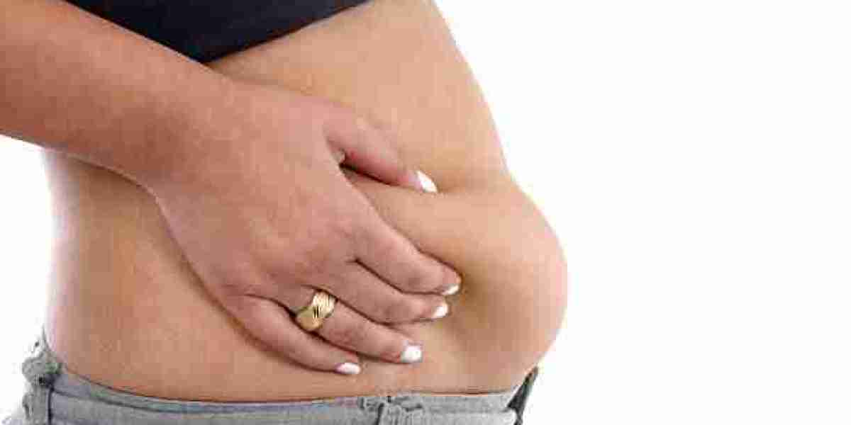 Tummy Tuck Surgery for Enhancing Your Overall Body Proportions