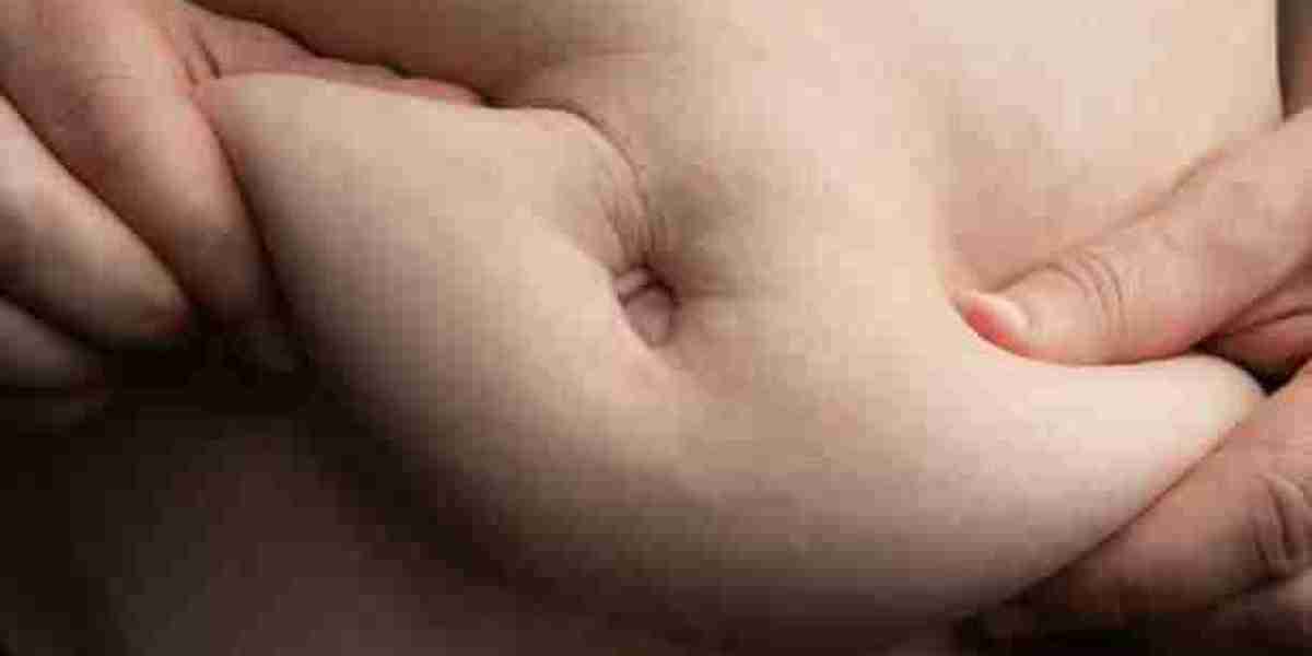 Top Factors to Consider Before Getting a Tummy Tuck in Riyadh