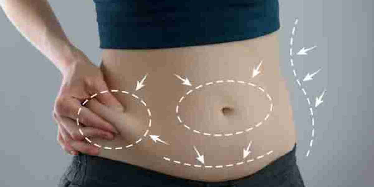 Post-Pregnancy Body Restoration with Mommy Makeover in Riyadh