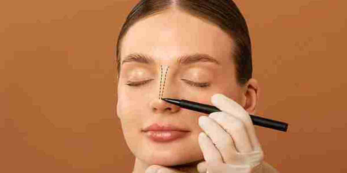 Rhinoplasty Explained for Smoother Nose Contours and Facial Proportion