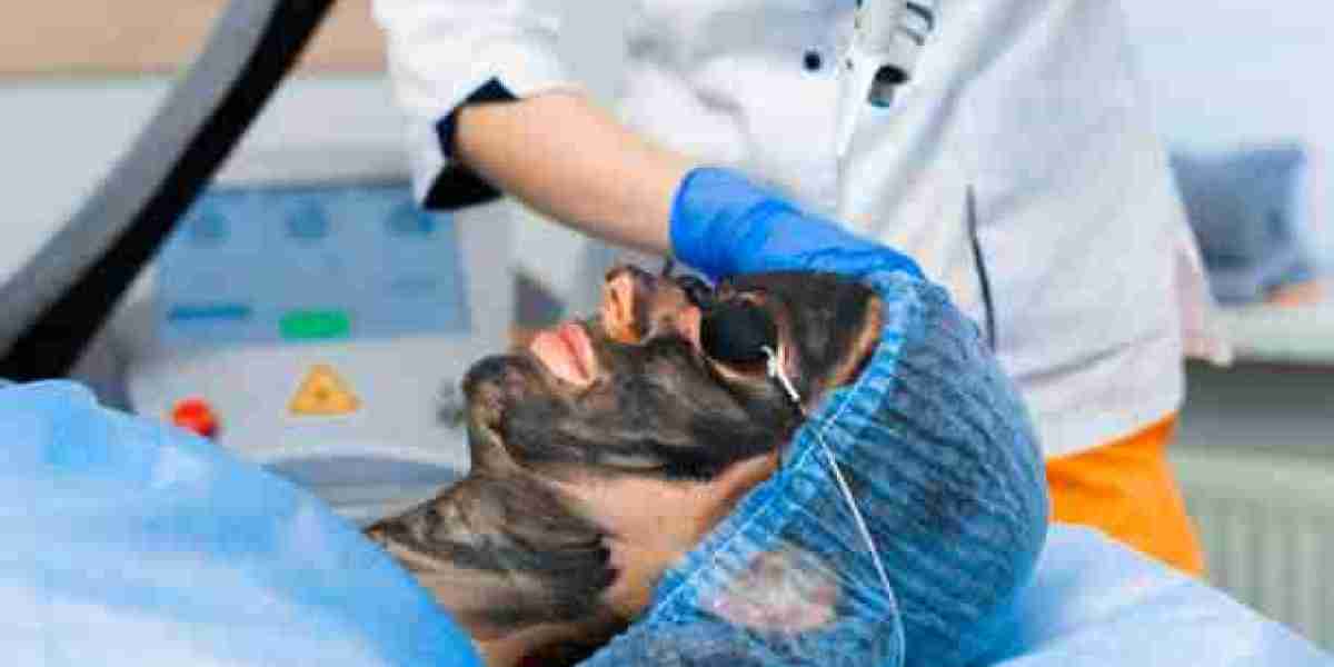 A Comprehensive Look at Spectra Laser Carbon Peeling Benefits for Skin