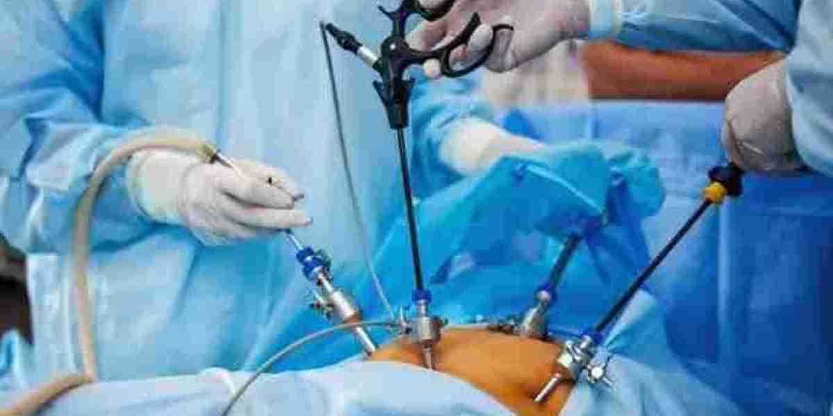 How to Prepare for Laparoscopic Surgery in Islamabad
