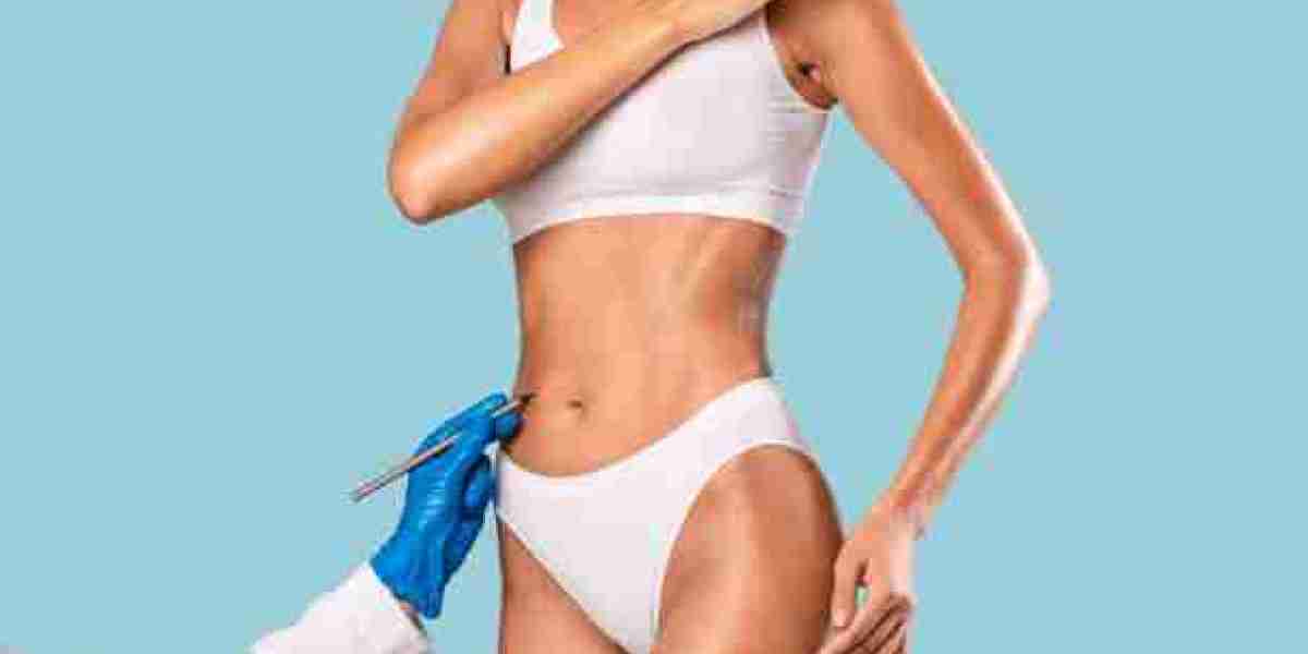 Liposuction in Riyadh: Sculpt Your Body and Boost Confidence