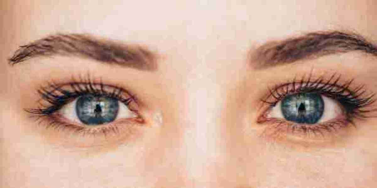 Eyelid Surgery Guide to Understanding the Procedure Process