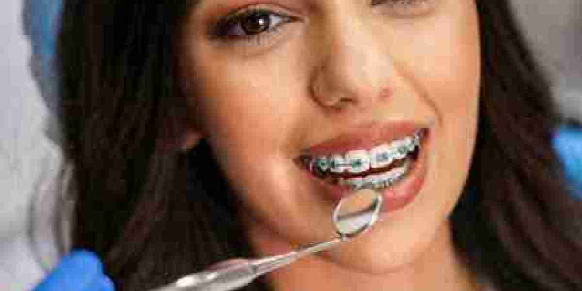 Best Dental Implants Near Me: Quality Care From Expert Dentists