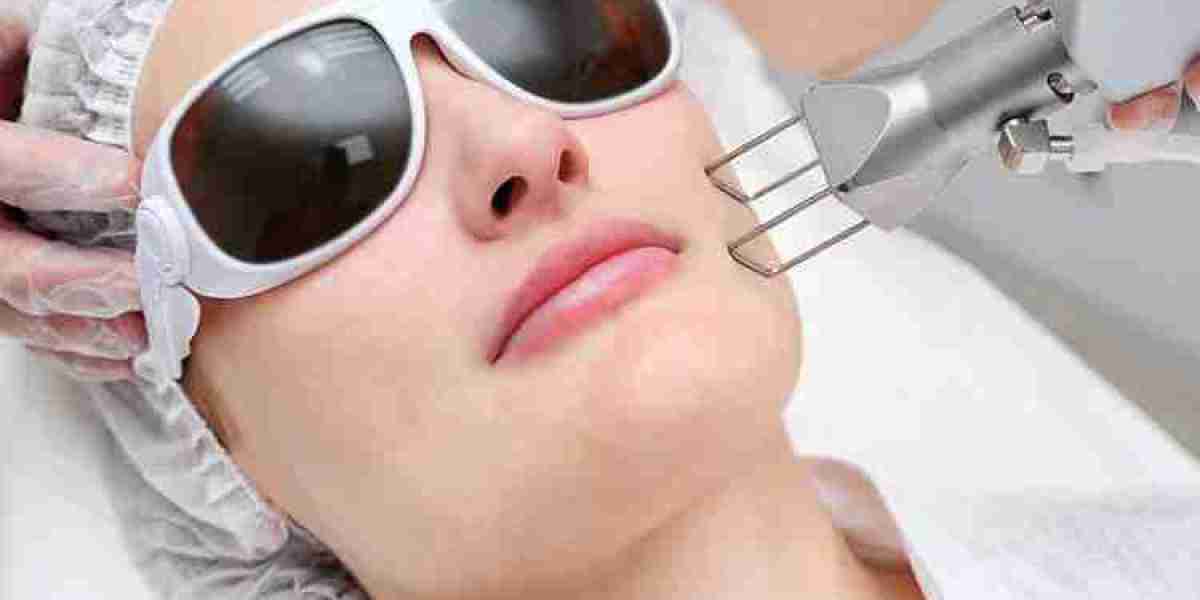 علاج الليزر الجزئي CO2 في الرياض: علاج المسام الواسعة بفعالية