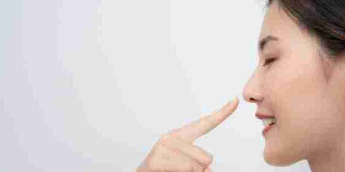 Rhinoplasty for Addressing Uneven Nasal Tip Definition